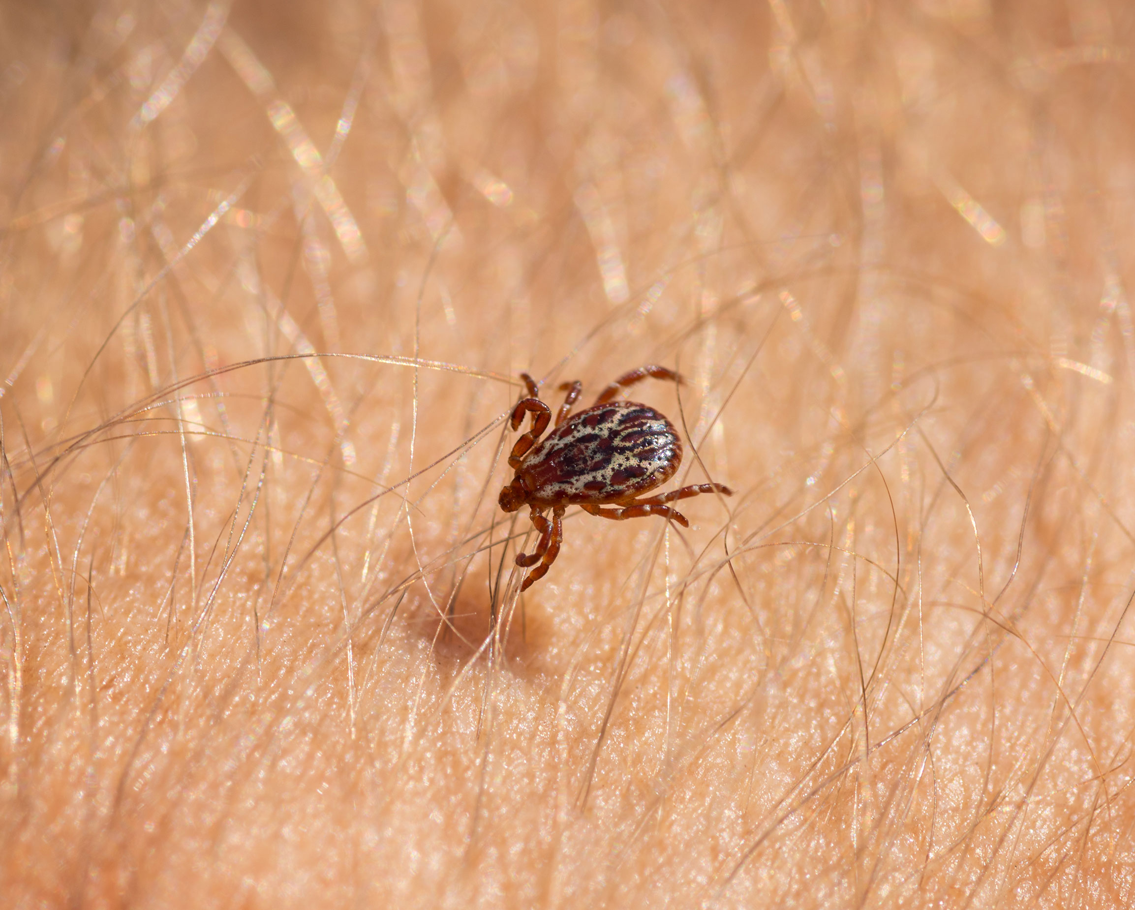 American dog tick on human skin.